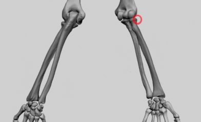 Radiusköpfchen und abgebrochene Stelle